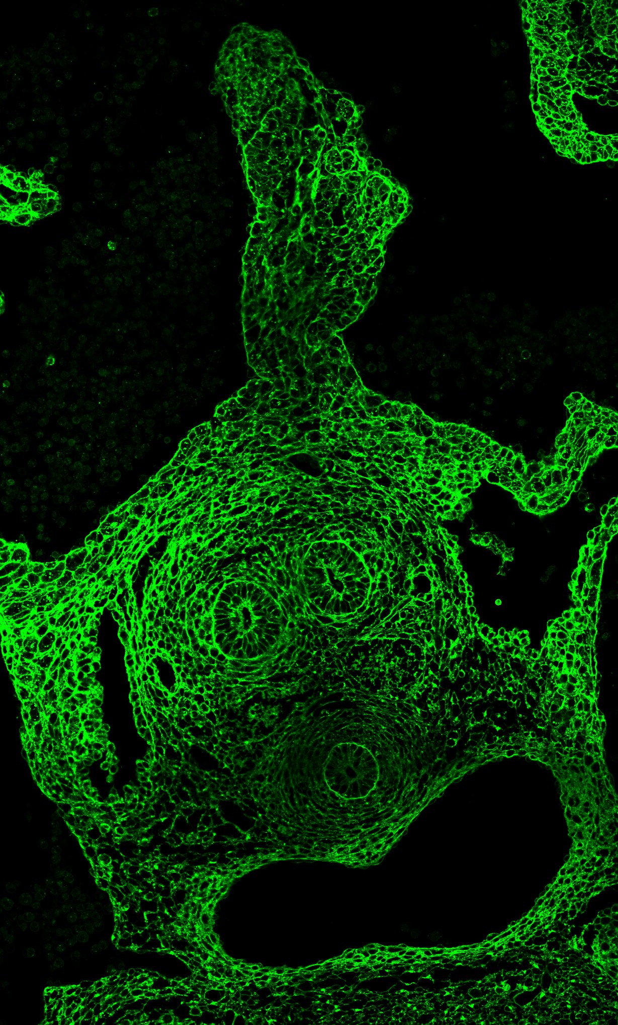 The Grinch Strikes at the Cellular Level